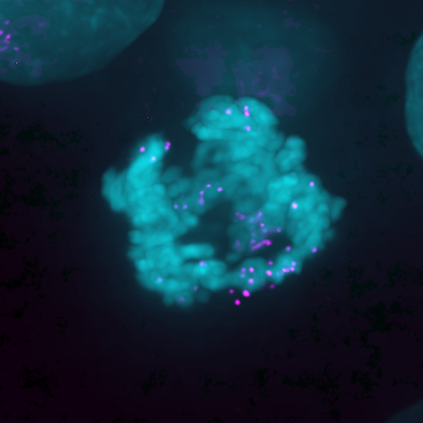 Illustration of extrachromosomal DNA foci (magenta) associated with mitotic chromosomes (cyan)