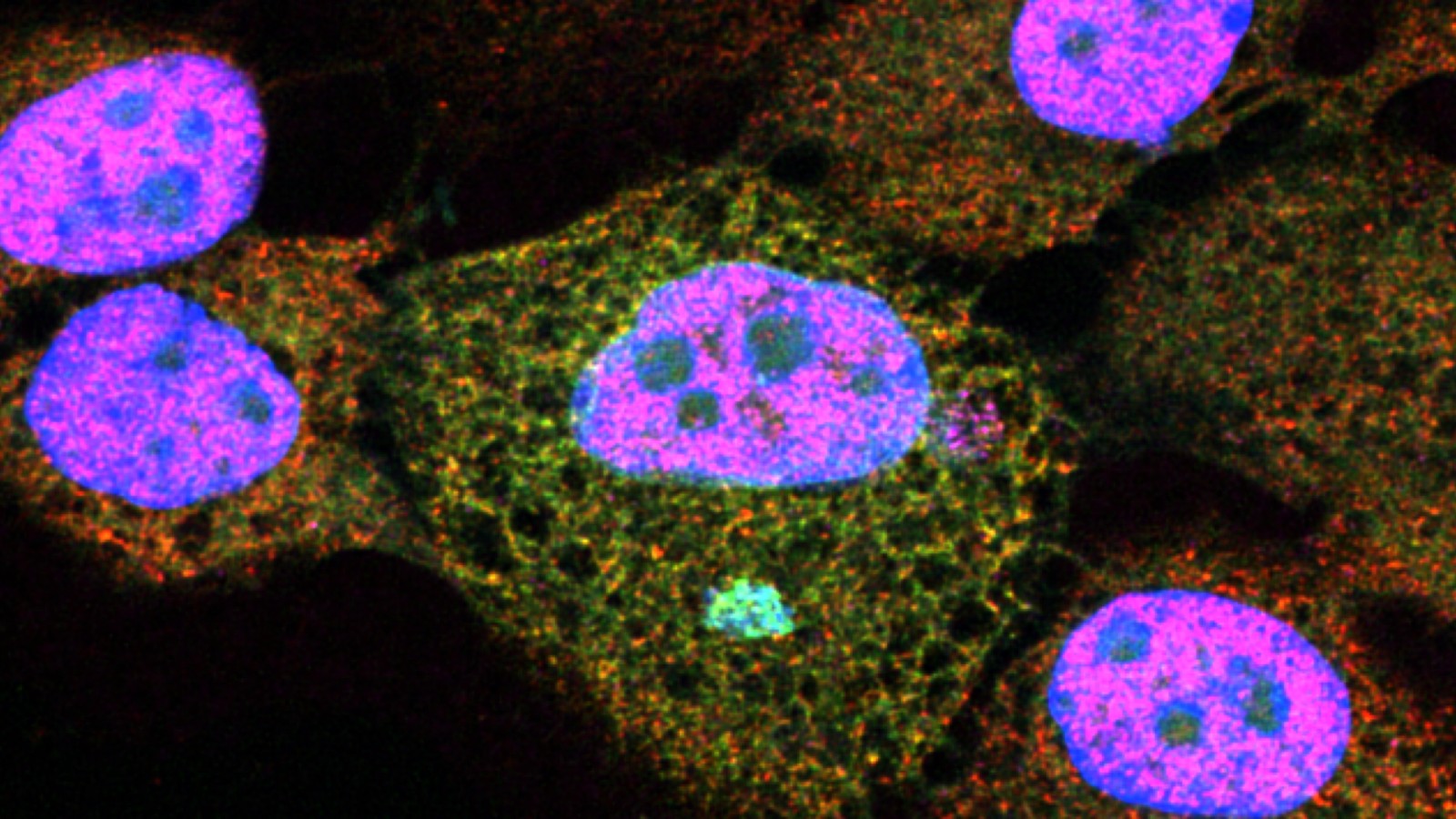 Immunofluorescence showing TREX1 (green) accumulating on a ruptured micronucleus, with DNA in blue